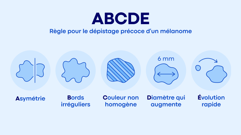 La règle ABCDE : un réflexe simple pour surveiller sa peau : A – Asymétrie, B – Bords irréguliers, C – Couleur non homogène, D – Diamètre qui augmente, E – Évolution rapide